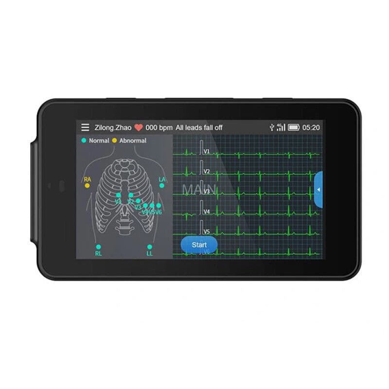 Portable 12-Lead ECG Monitor PCECG-500