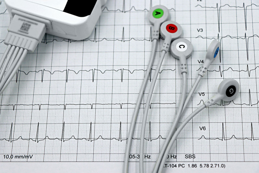 Advances in Arrhythmia Diagnosis: The Rise of Handheld and Smartphone ECGs