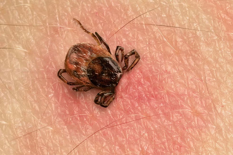 Check for Lyme Disease